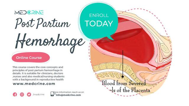 Post partum hemorrhage (PPH)Online Course