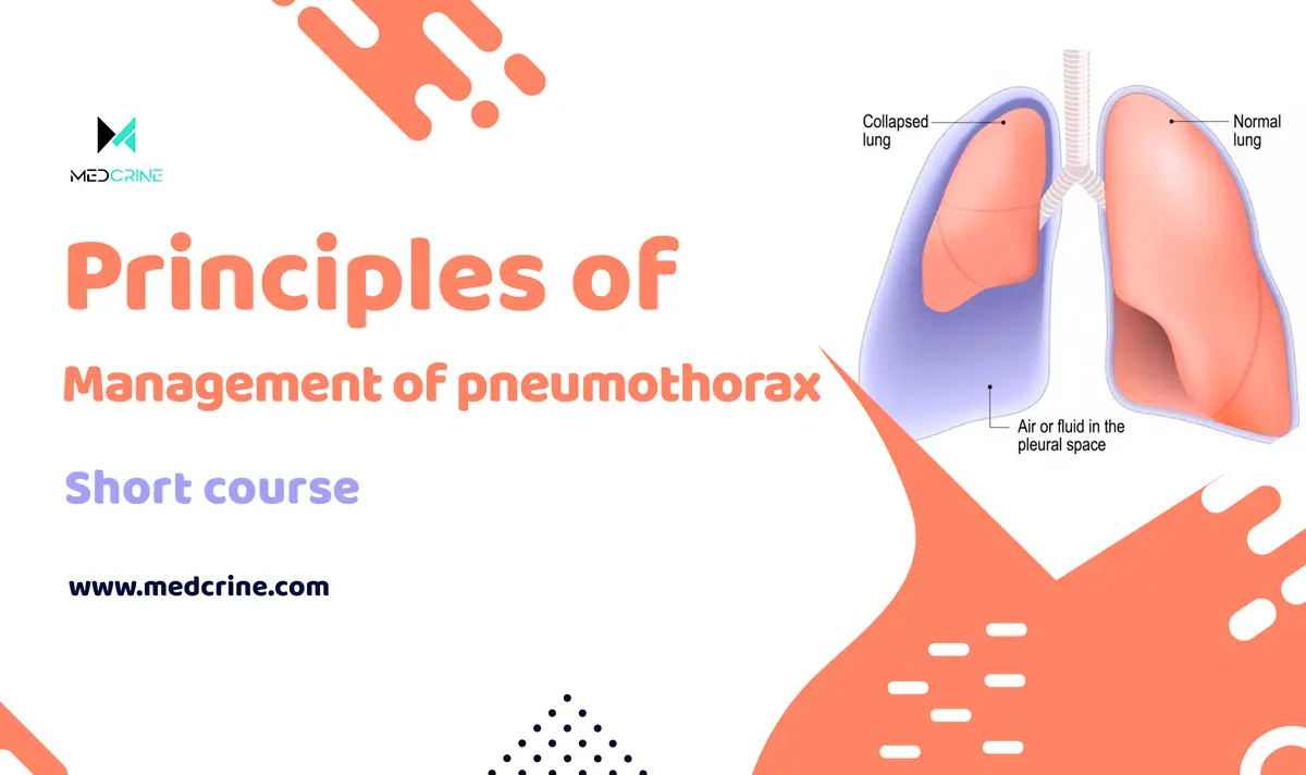 Principles of management of Pneumothorax Online Course