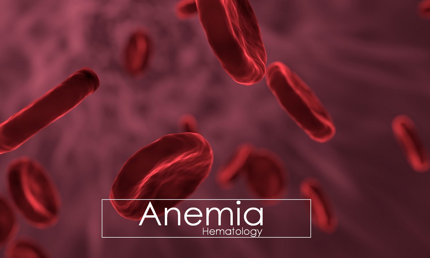 Anemia: Classification, Signs and Symptoms, Treatment