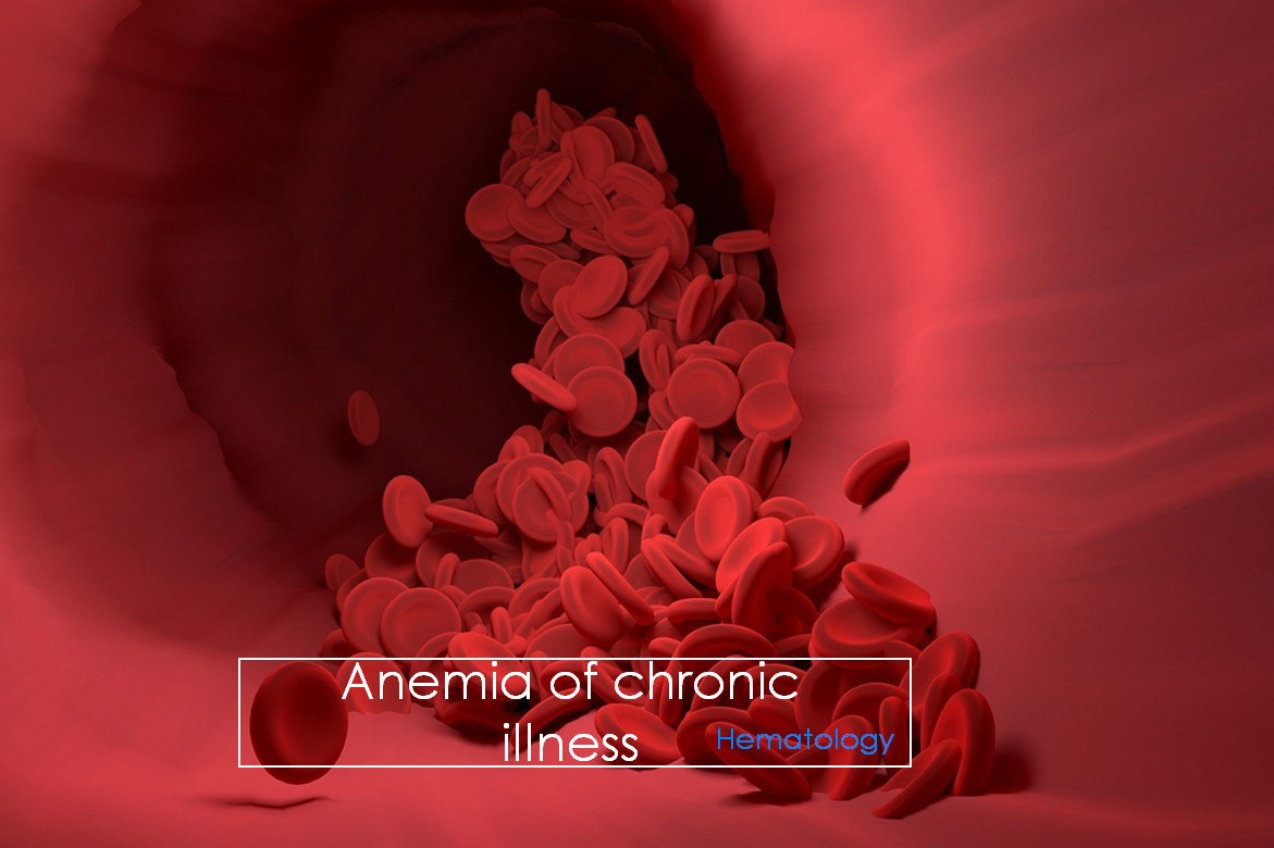 Anaemia of Chronic Illness: Causes and Pathophysiology