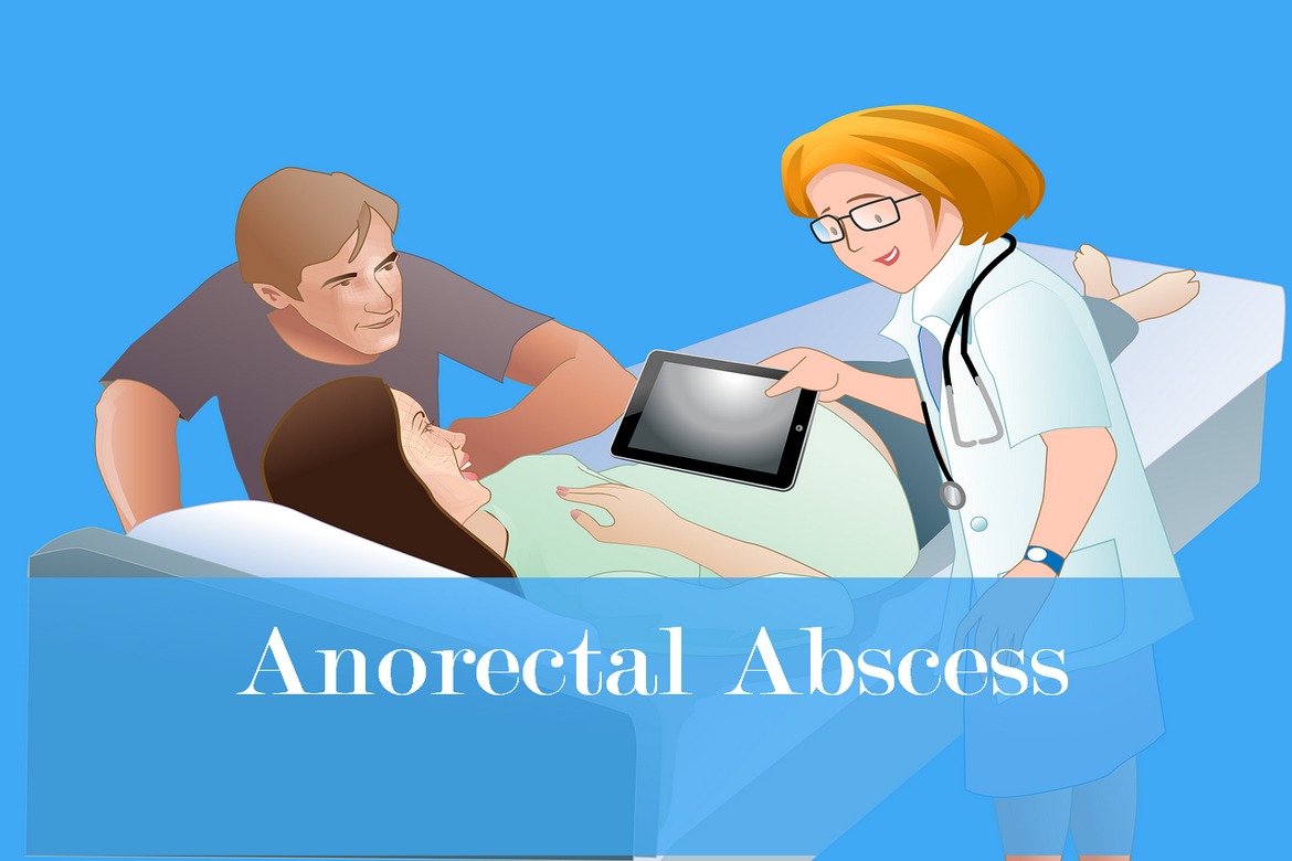 Anorectal Abscess: Causes, Symptoms, and Treatment