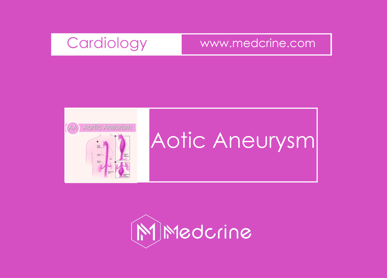 Aortic Aneurysm: Thoracic and Abdominal aortic Aneurysm
