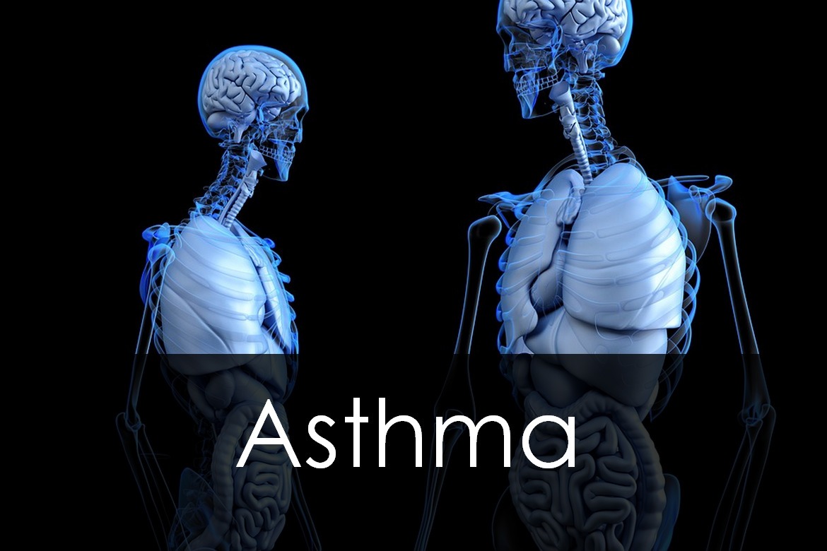 Asthma: Types, Causes, Symptoms, Diagnosis and Treatment