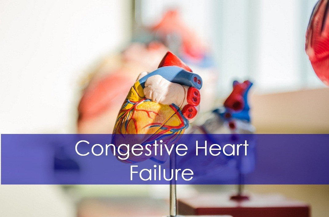 Congestive Heart Failure (CHF): Causes,Signs and Treatment Guidelines