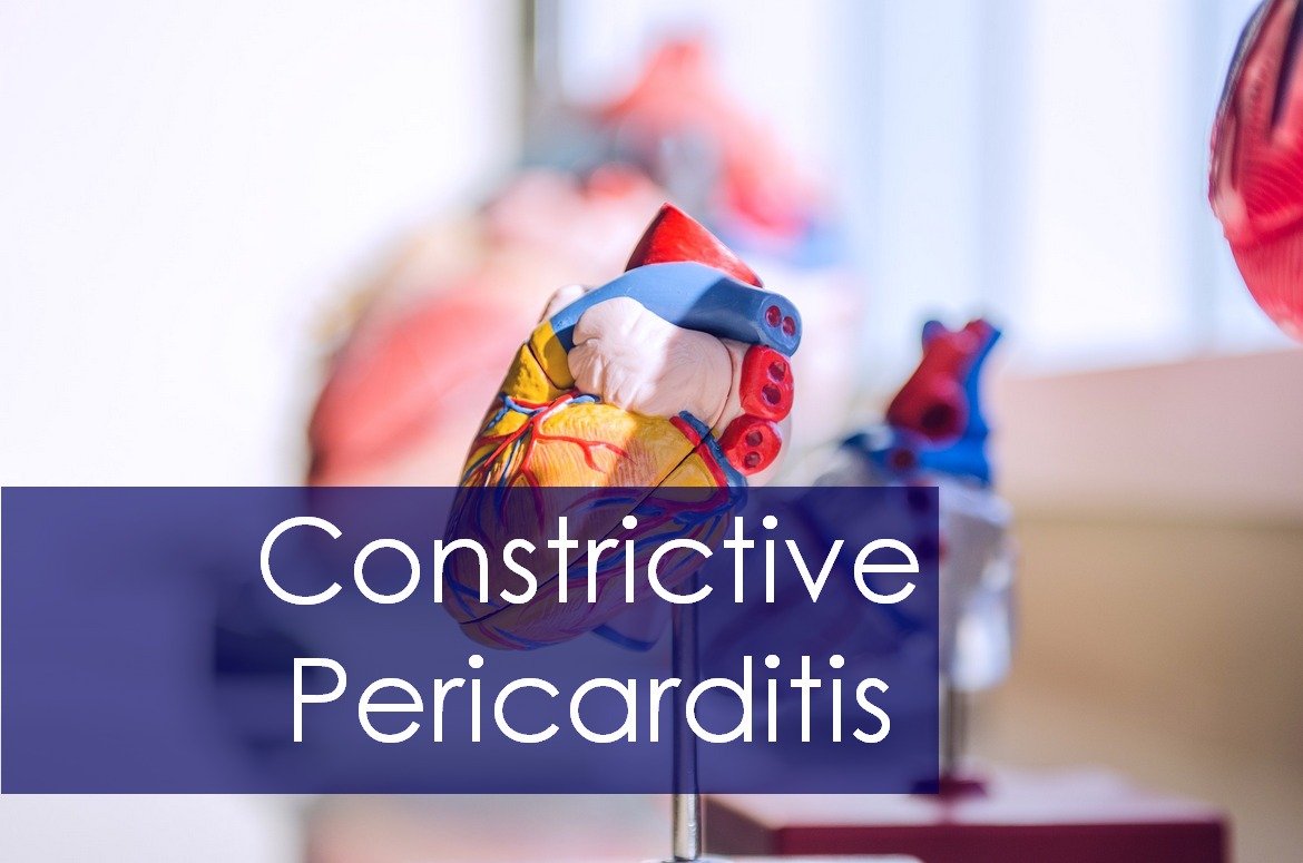 Constrictive Pericarditis ; Causes, Symptoms, and Treatment