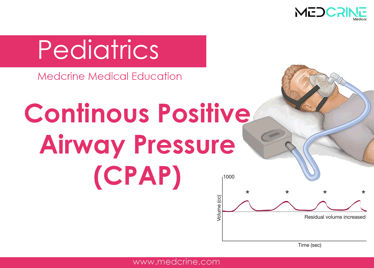 Continuous positive airway pressure (CPAP)