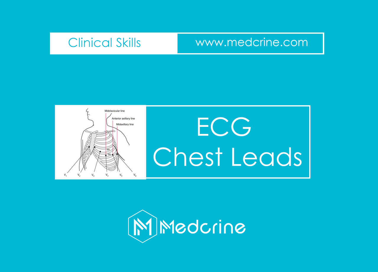 ECG Leads : Precordial /Chest Leads Placement