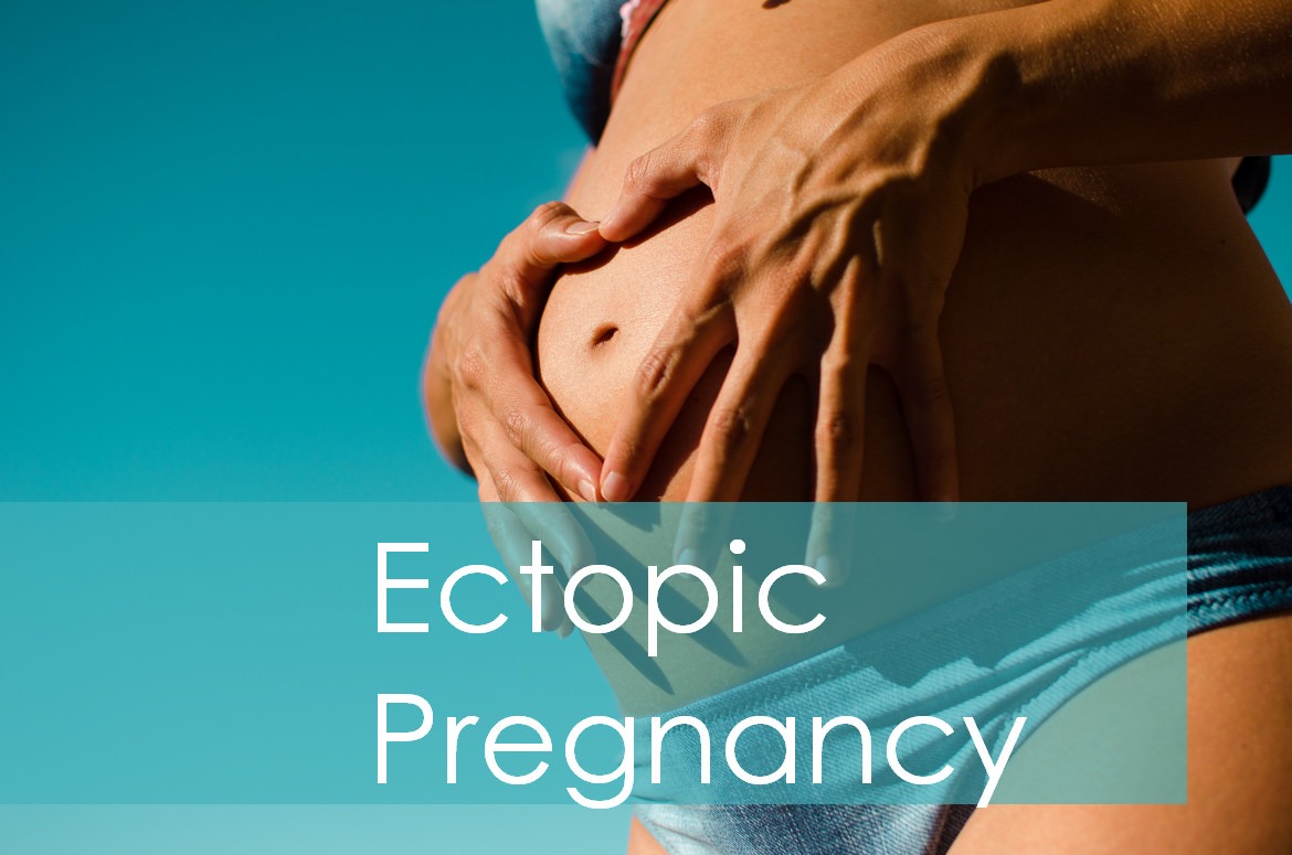 What causes an ectopic pregnancy?