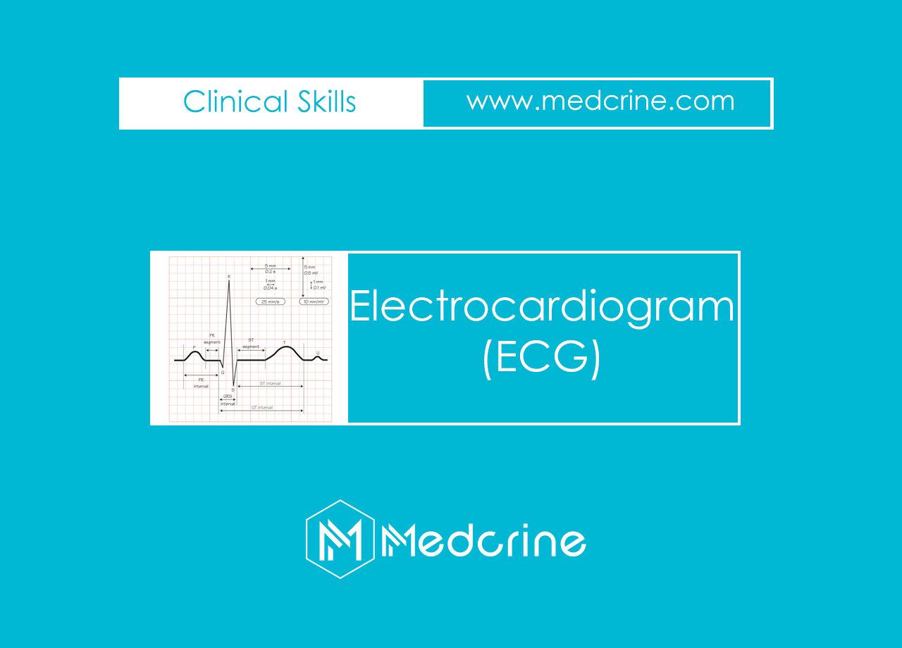 Electrocardiogram Physiology, Waves, Intervals, Axis and Segments