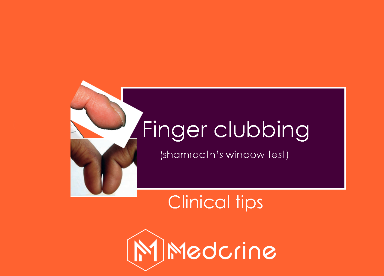Finger clubbing: Causes, Grading and Schamroth’s sign