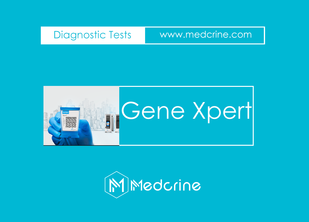 GeneXpert MTB/RIF for Tuberculosis Diagnosis