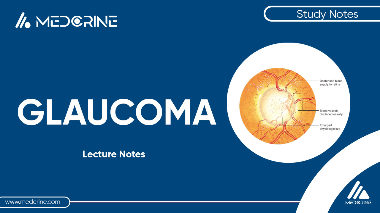 Glaucoma Lecture Notes