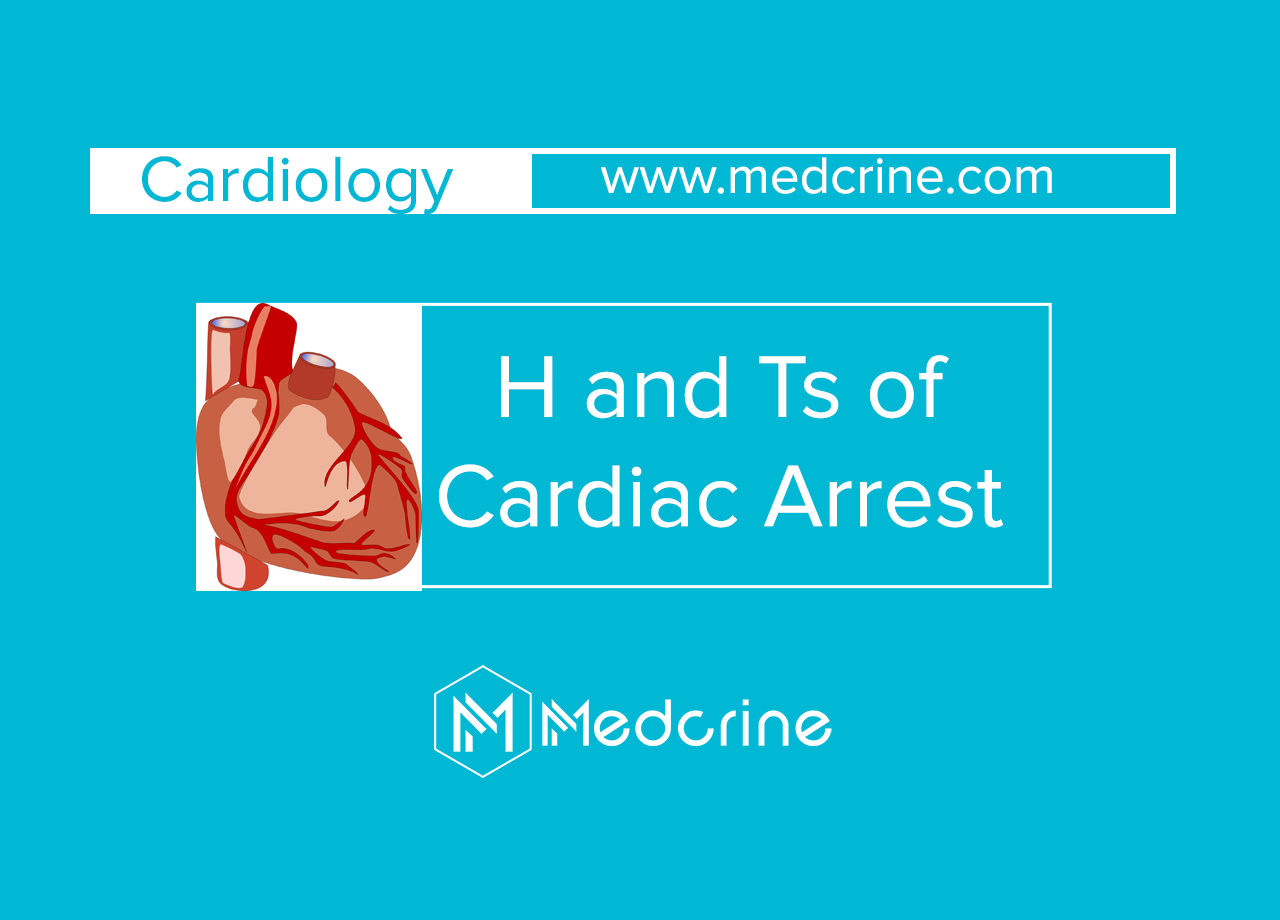 H's and T's of Cardiac Arrest