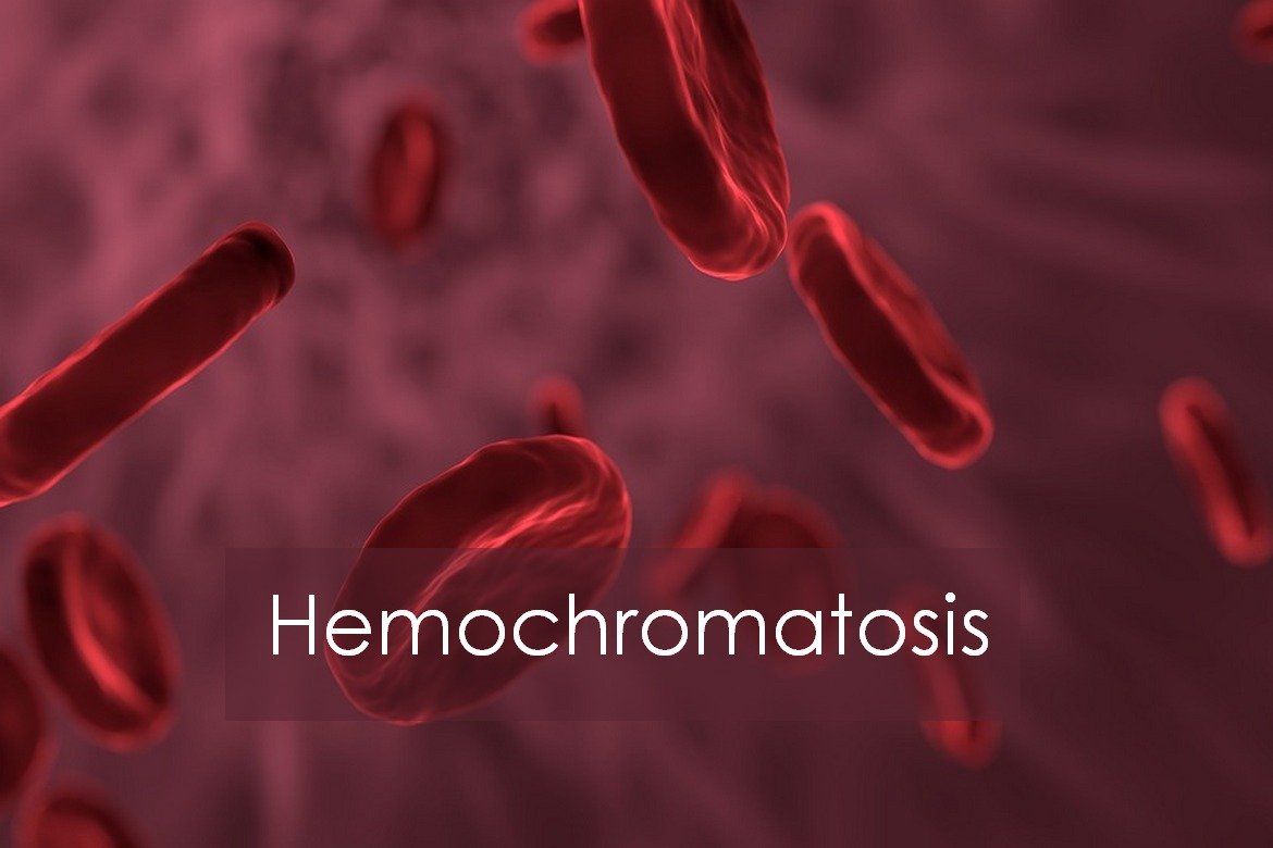 Hemochromatosis: Causes, Symptoms, Diagnosis and Treatment