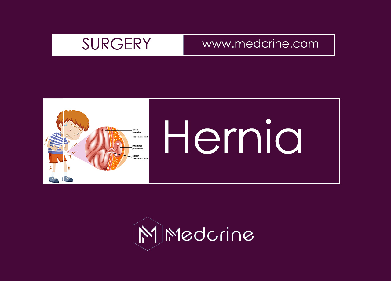 Composition, Classification and Clinical Features of Hernia