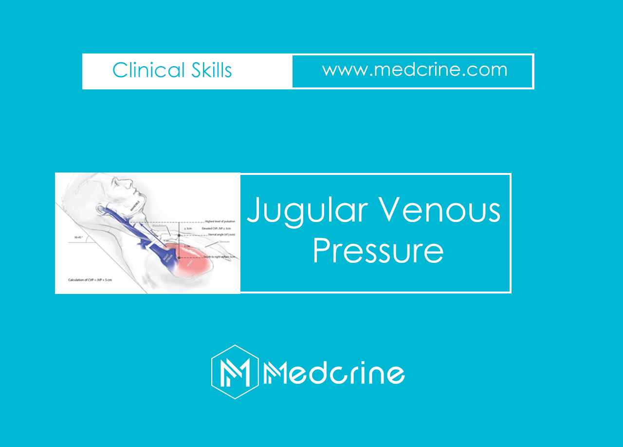 Jugular Venous Pressure Examination and Interpretation