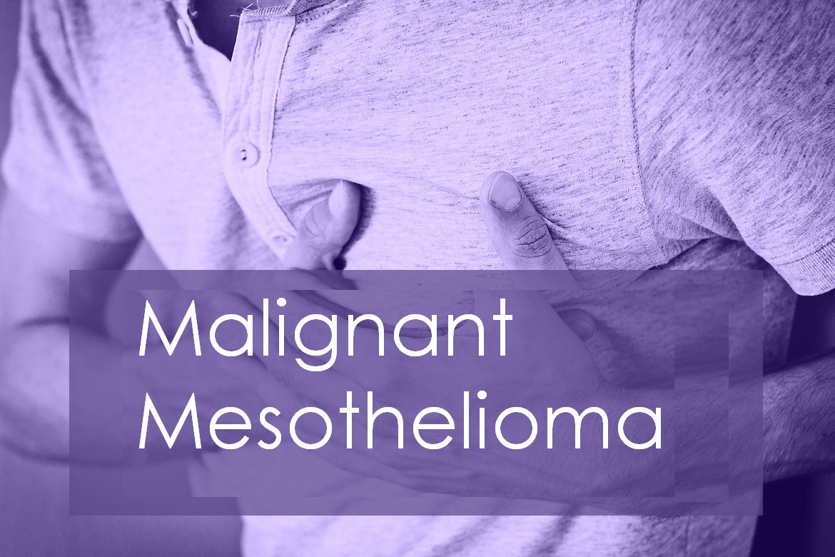 Malignant Mesothelioma Cancer