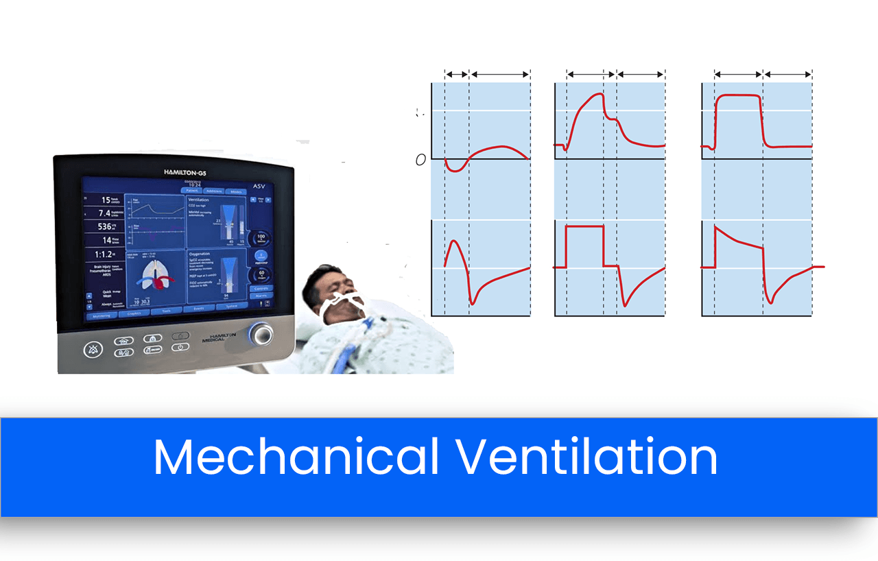 Modes of Invasive Mechanical Ventilation and their Indications
