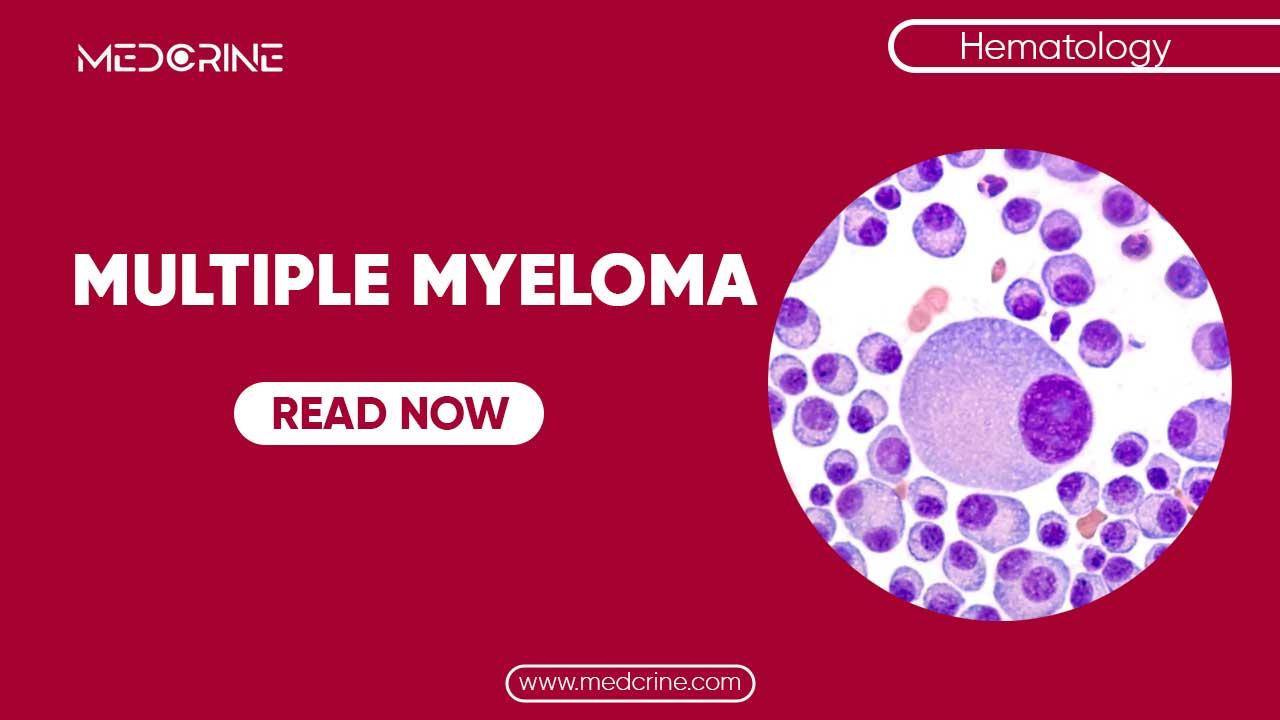 Multiple Myeloma Symptoms, Pathophysiology and Diagnosis