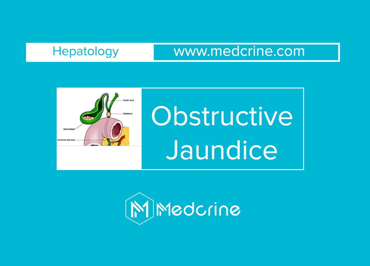 Obstructive Jaundice: Causes, Symptoms and Treatment