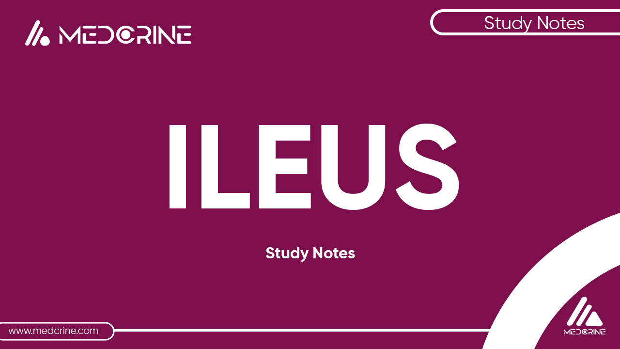 Ileus: Causes, Symptoms and Treatment thumbnail