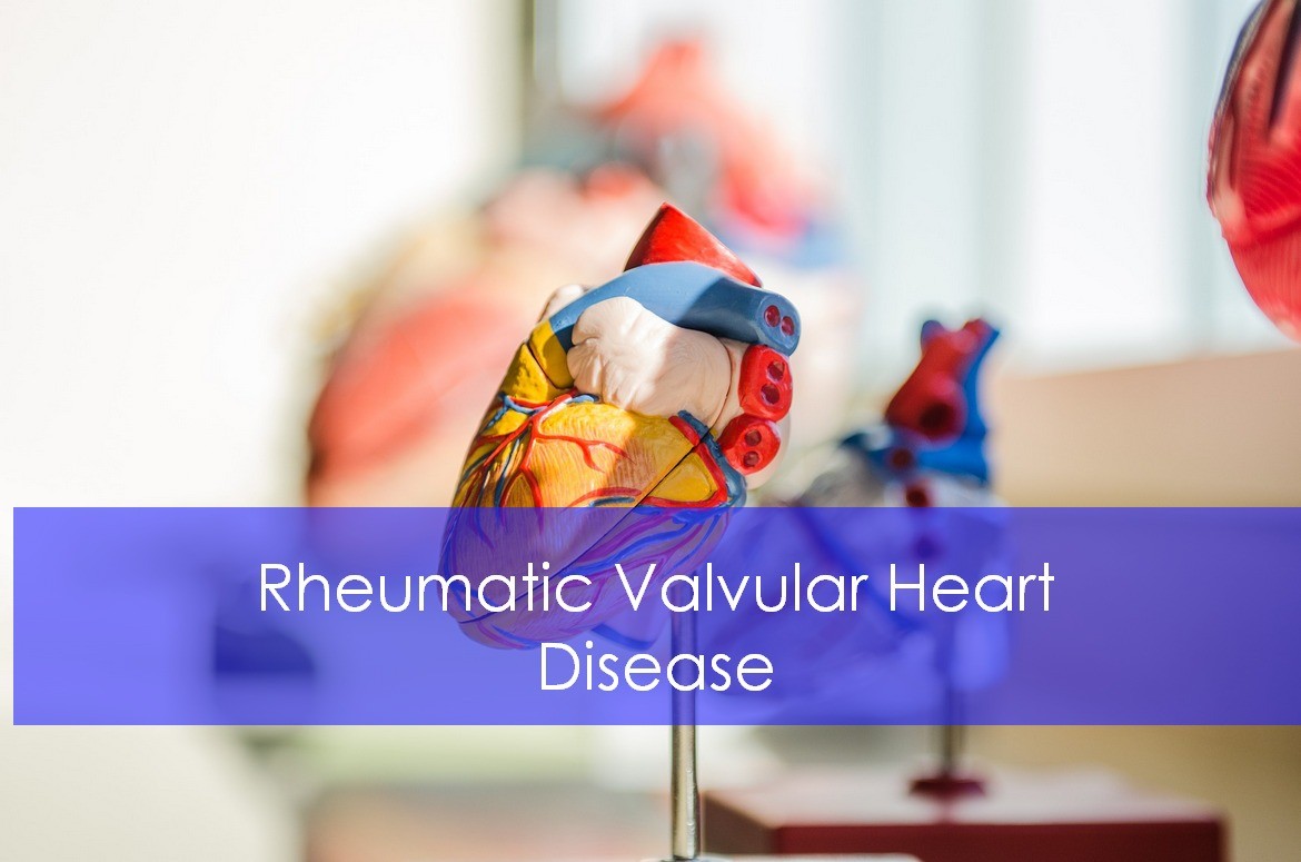 Rheumatic Valvular Heart Disease