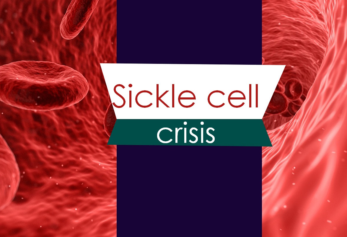 Types of sickle cell crisis: Aplastic, Vaso-occlusive, Hemolytic and Sequestration