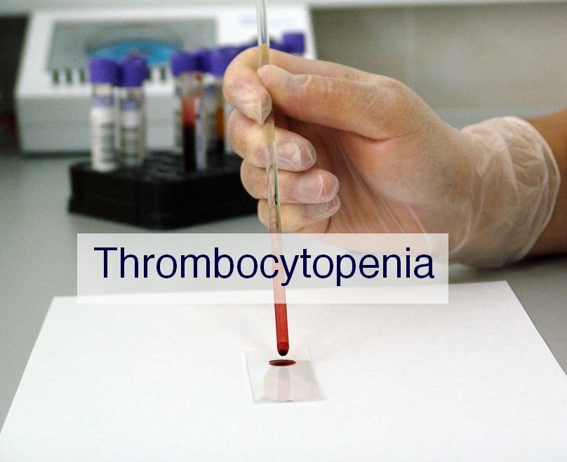 Thrombocytopenia: Low Platelet Count